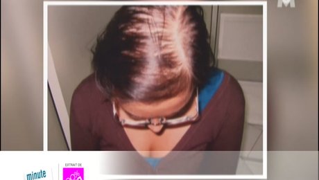 probleme chute de cheveux femme probleme chute de cheveux femme