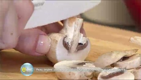 champignon dans le corps champignon dans le corps
