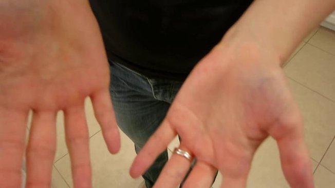 Tache Orange Sur Les Mains Au Réveil