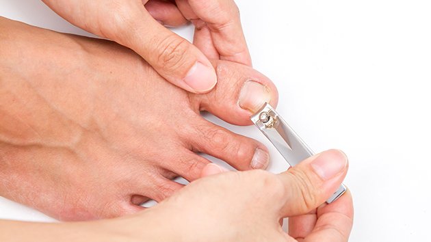 La coupe des ongles